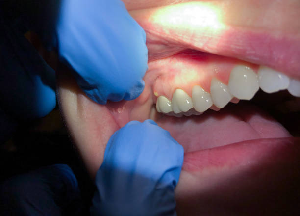 Best Emergency Treatment for Jaw Pain or Injury in Canyon Lake, TX