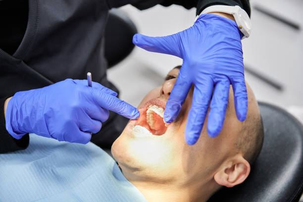 Best Knocked-Out Tooth (Avulsed Tooth) Treatment in Canyon Lake, TX